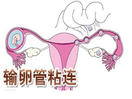 <b>输卵管粘连居然怀孕了，但是输卵管却粘连了</b>