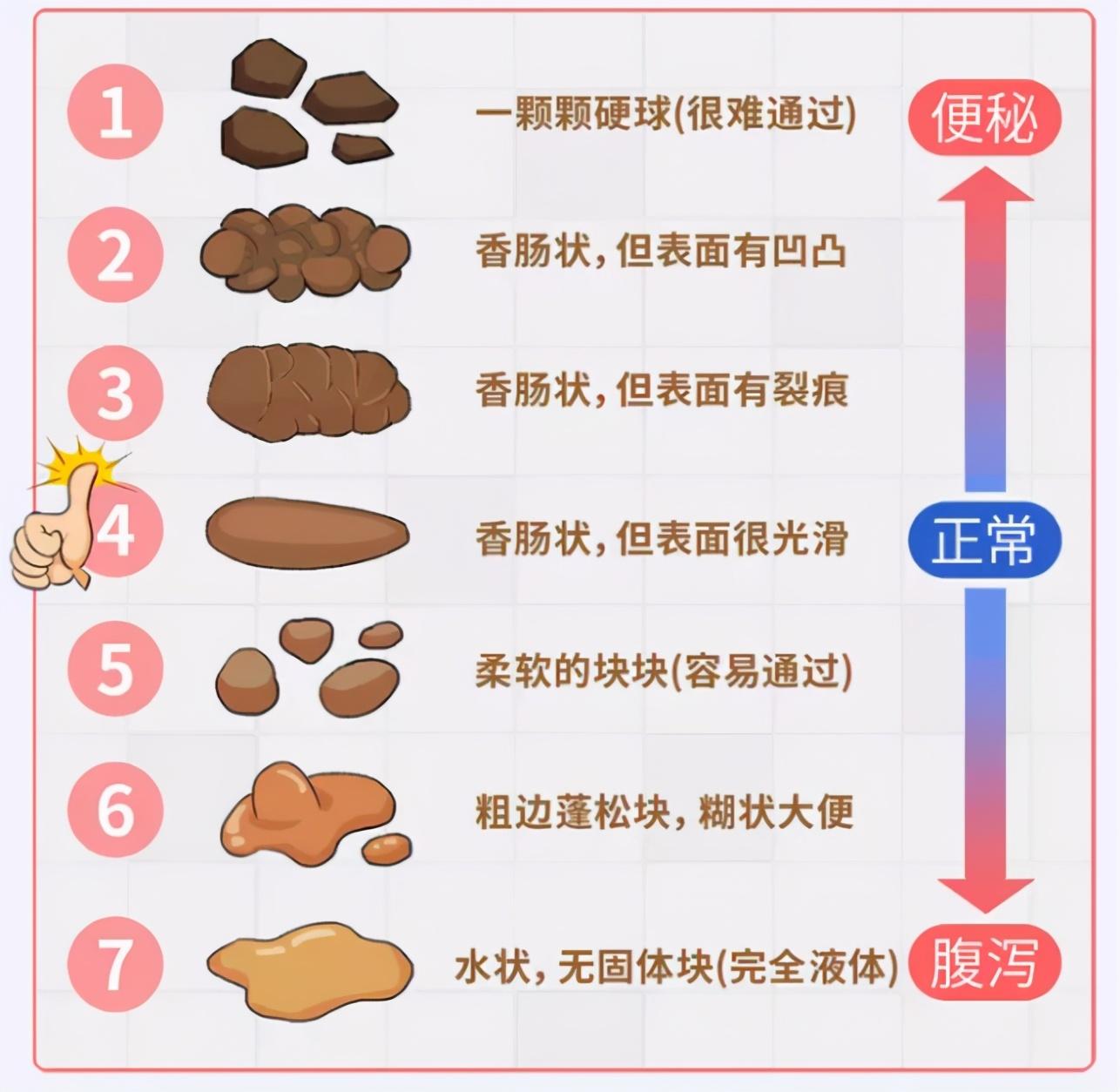 奶瓣便和蛋花便的区别,婴儿大便对照表