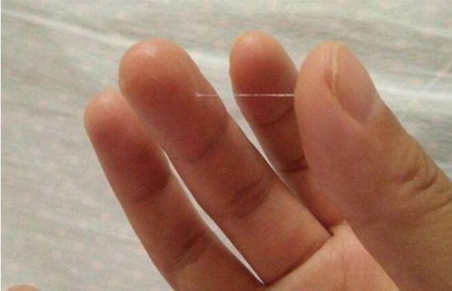 白带拉丝后多久排卵,可能很多女人算错了 - 四明妇幼