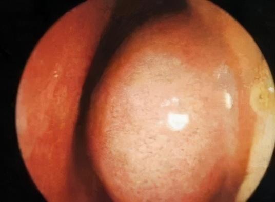 宝宝鼻塞流鼻涕小妙招,6招让娃吃得好睡得香