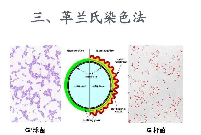 革兰氏染色法 快懂百科