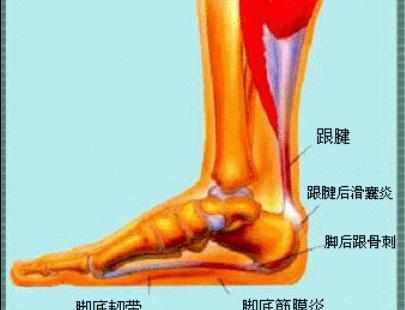足跟骨刺 快懂百科