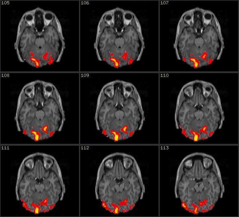 Fmri 快懂百科