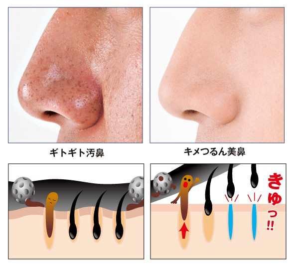 角栓 快懂百科