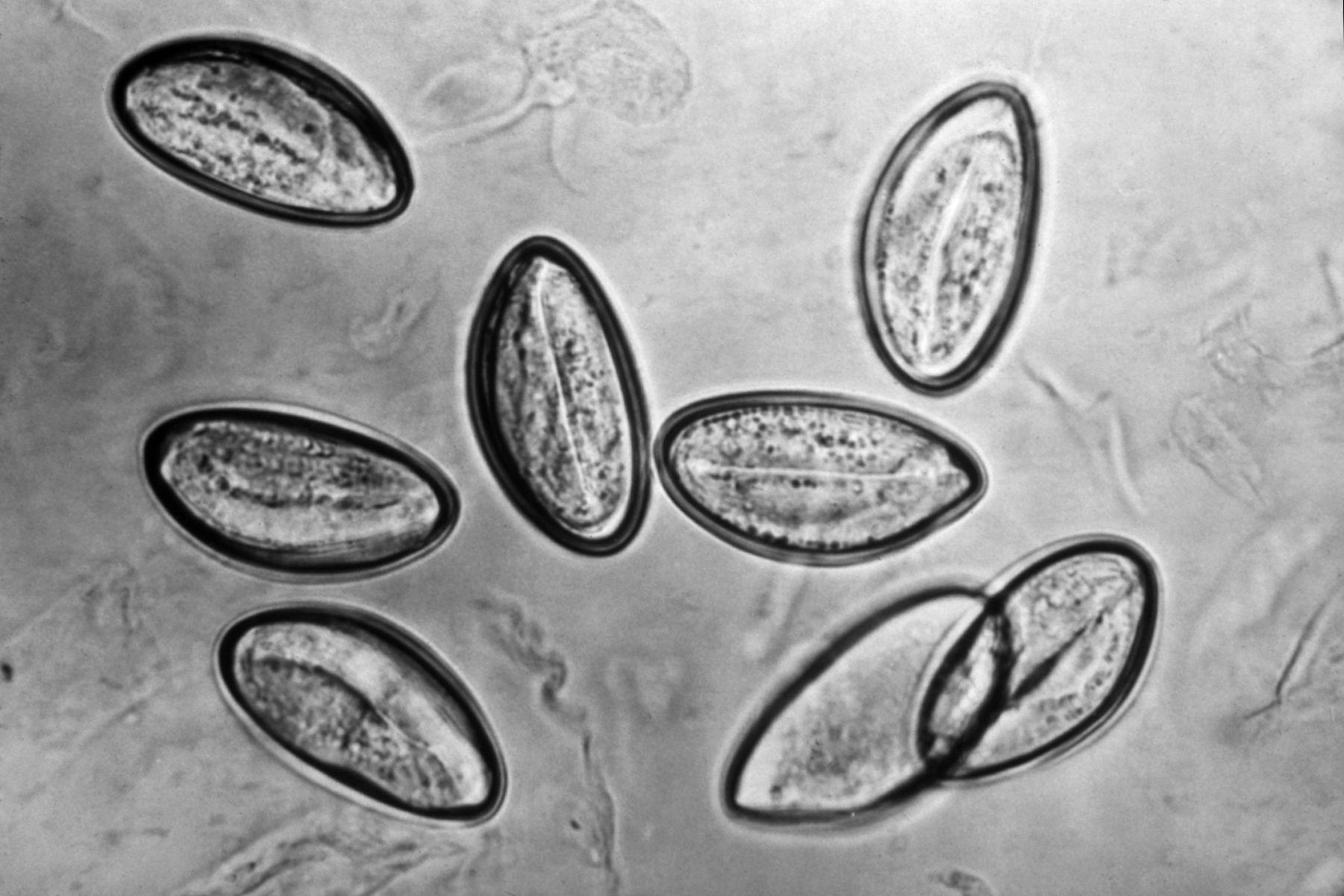 Pinworm鸡蛋(蛲虫vermicularis) 库存图片. 图片 包括有 enterobius, eggs - 149376347