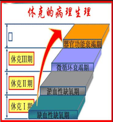 失血性休克 - 快懂百科