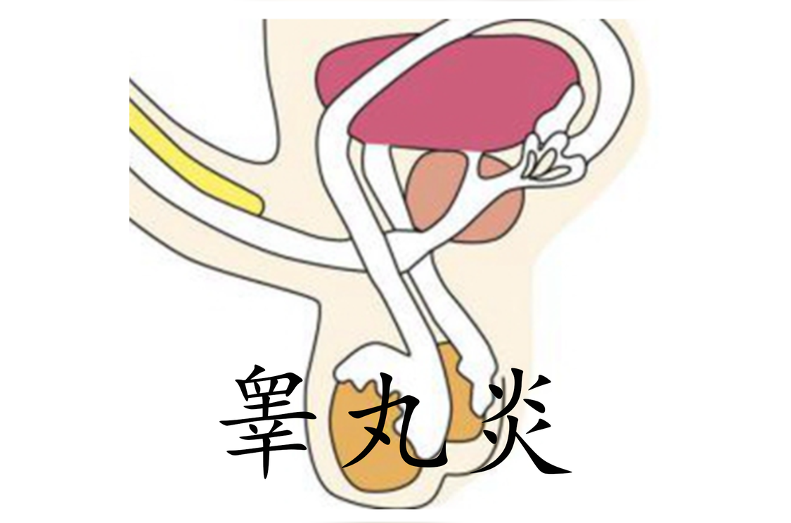 睾丸炎 男性生殖系统的常见炎症 头条百科