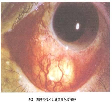 巩膜疾病 快懂百科