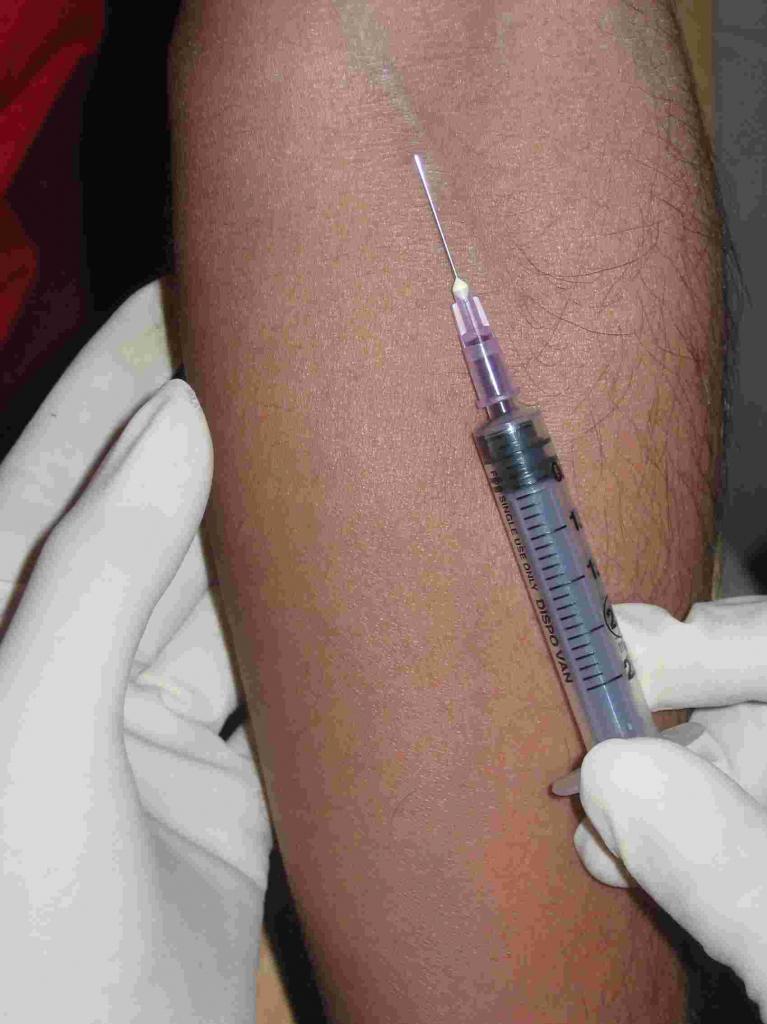 静脉采血法 快懂百科