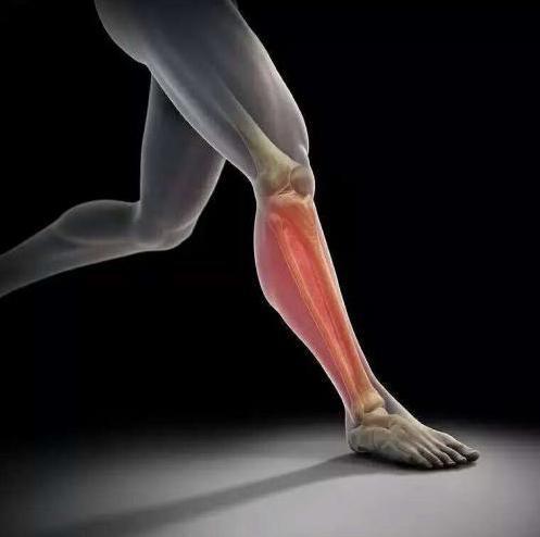 疲劳性骨膜炎 快懂百科