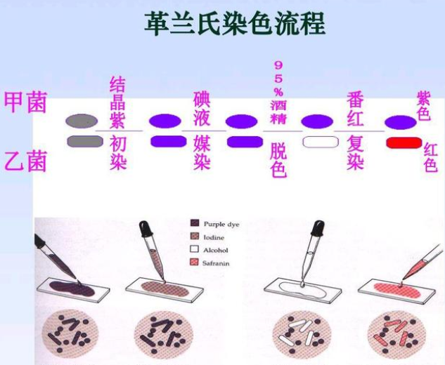 革兰氏菌 快懂百科