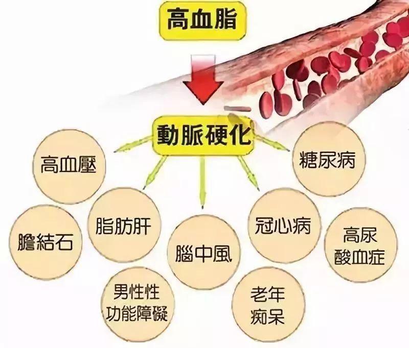 血脂异常 - 快懂百科